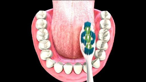 Why are my dentures always changing fit and can it be fixed?