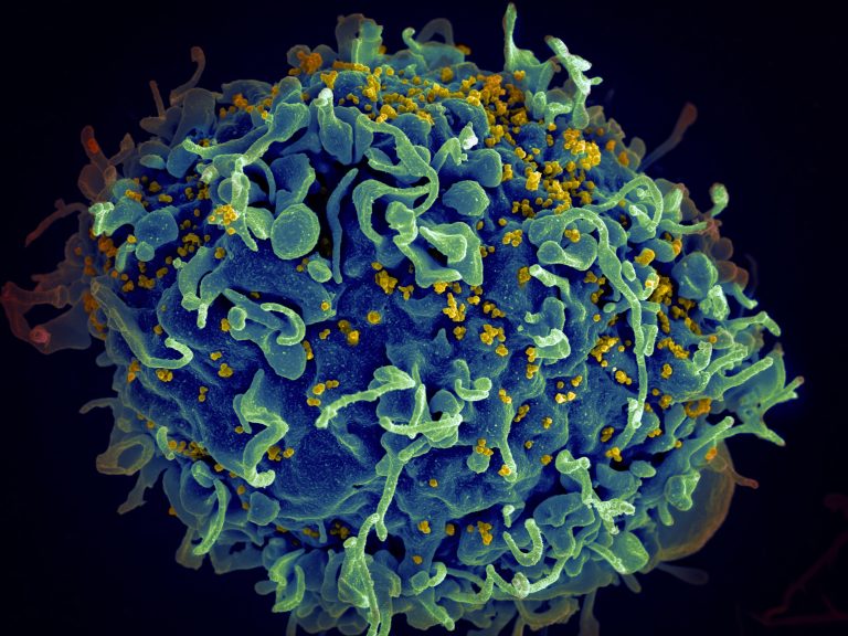 Understanding Infectious Diseases: Causes, Impact, and Prevention StrategiesIntroduction: Understanding the Importance of Infectious Diseases